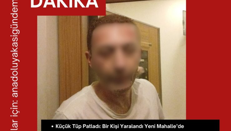 Isınmak İçin Yaktığı Tüp Patladı!
